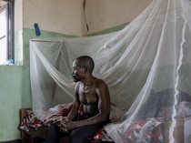 Wabah Mpox di Afrika Makin Tak Terkendali, Tembus Hampir 3.000 Kasus