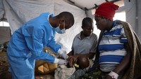Dokter di Kinshasa, ibu kota Republik Demokratik Kongo (DRC), melakukan perawatan untuk pasien yang menderita mpox saat rumah sakit terus berjuang melawan lonjakan kasus.