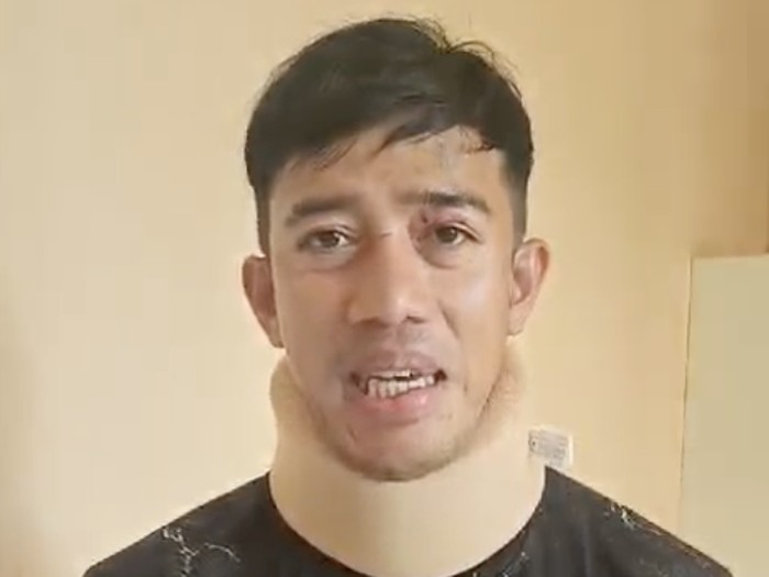 Ruri Repvblik setelah kecelakaan.