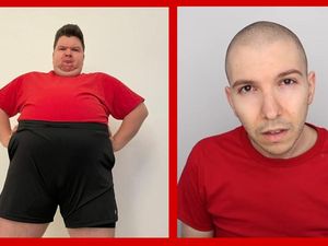 Nikocado Avocado Tetap Bikin Konten Mukbang Usai Turun BB 113 Kg