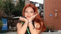 Terkenal sebagai selebgram dan influencer, Shafa Harris baru saja membagikan fotonya usai jalani operasi plastik di Korea Selatan. Foto: Instagram @shafaharris