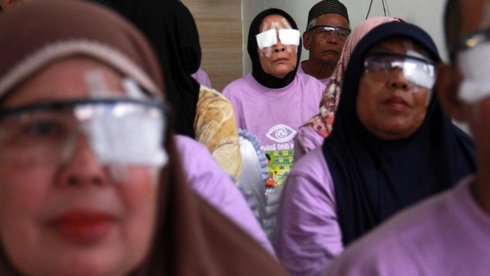 Petugas kesehatan melakukan operasi katarak gratis di Rumah Sakit Mata Mencirim 77 Medan, Sumatera Utara, Senin (9/9/2024). PT Agincourt Resources menggelar operasi katarak gratis bagi 257 penderita katarak untuk meningkatkan kualitas hidup masyarakat yang lebih baik. ANTARA FOTO/Yudi Manar/Spt.