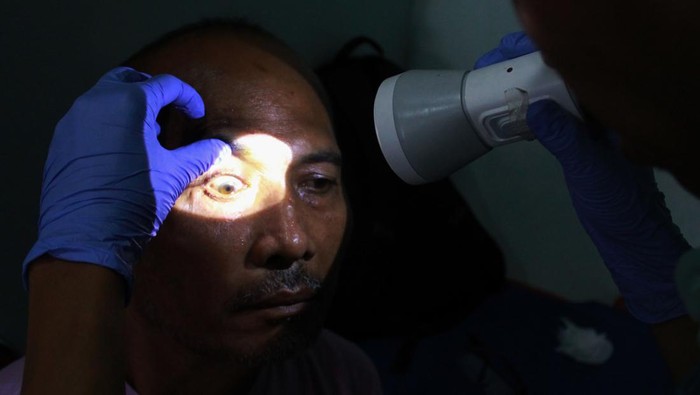 Petugas kesehatan melakukan operasi katarak gratis di Rumah Sakit Mata Mencirim 77 Medan, Sumatera Utara, Senin (9/9/2024). PT Agincourt Resources menggelar operasi katarak gratis bagi 257 penderita katarak untuk meningkatkan kualitas hidup masyarakat yang lebih baik. ANTARA FOTO/Yudi Manar/Spt.