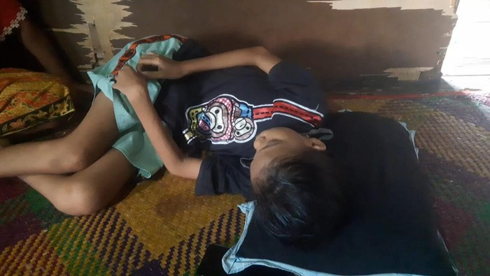 Yola Puspita (12), bocah di Ogan Ilir yang alami gizi buruk.
