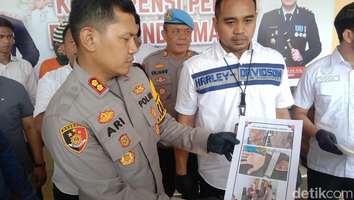 Polisi menunjukkan bukti luka yang dialami korban penjambretan
