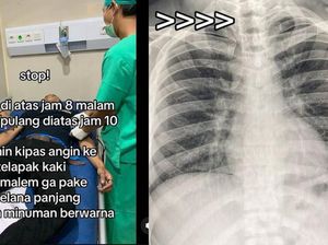 Viral Penampakan Paru-paru Basah Disebut gegara Kipas Angin, Ini Catatan Dokter