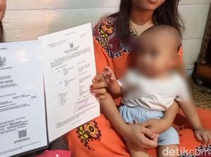 Balita di Palembang Alami Kelamin Ganda, Butuh Bantuan Pengobatan