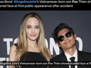 Penampilan Perdana Anak Angelina Jolie Usai Keluar ICU, Ada Bekas Luka di Dahi