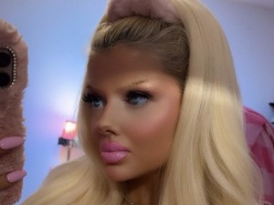 Wanita Habiskan Rp 160 Juta untuk Oplas Mirip Barbie, Diejek Mirip Badut