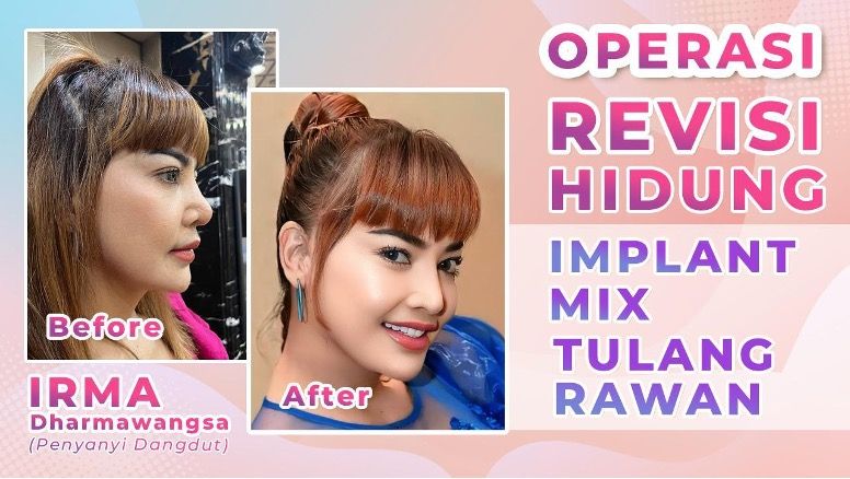 adv klinik bedah adv klinik bedah