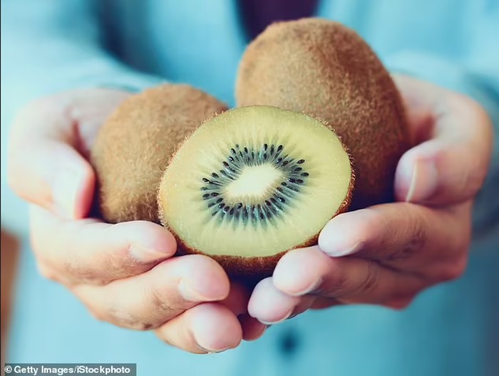 Ahli Diet Ini Beberkan Cara Aneh Makan Kiwi yang Menyehatkan