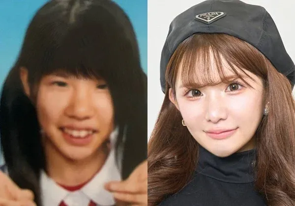 Hirase Airi, influencer habiskan Rp 2,1 miliar untuk operasi plastik.