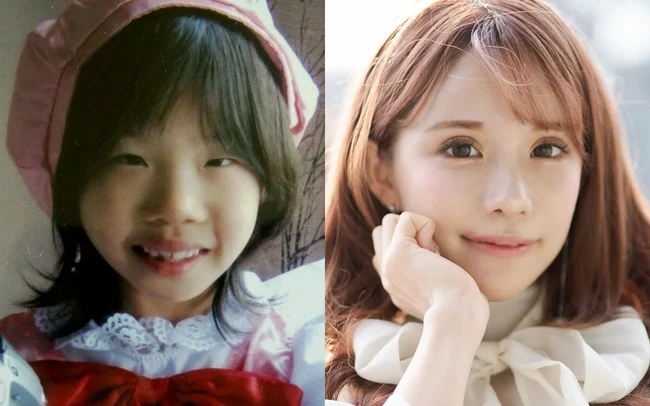 Bahkan saat sudah remaja, wajahnya selalu mengundang cibiran. Foto: Instagram/@nyairin_18