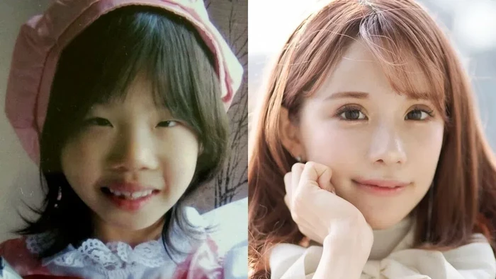 Viral Influencer Habiskan Rp 2 M demi Operasi Plastik, Parasnya Bikin Melongo