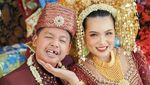 Dustin Tiffani Pantas Gelar Resepsi Nikah 4 Kali, Bayaran Kerjanya Nggak Main-main