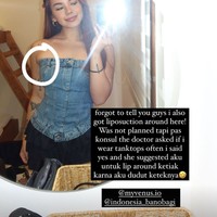 Tak hanya bagian hidung, Shafa juga mengungkapkan jika dirinya sekaligus menjalani oplas payudara serta sedot lemak. Sedot lemak tersebut dilakukan di area sekitar ketiaknya. Foto: Instagram/@shafaharris