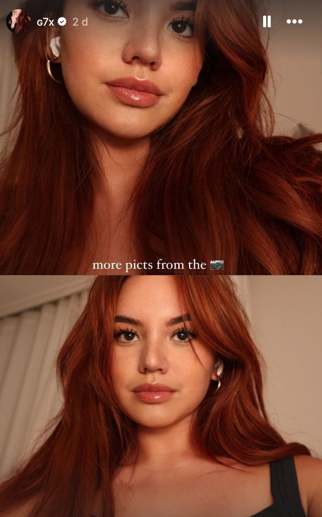 Kini sudah tak lagi diperban, wajah baru Shafa Harris pun sudah jelas terlihat. Banyak netizen yang memberikan pujian dan menyebut jika operasi plastik Shafa berhasil. Foto: Instagram/@shafaharris