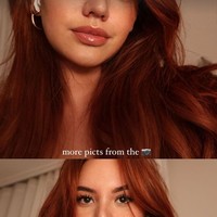 Kini sudah tak lagi diperban, wajah baru Shafa Harris pun sudah jelas terlihat. Banyak netizen yang memberikan pujian dan menyebut jika operasi plastik Shafa berhasil. Foto: Instagram/@shafaharris