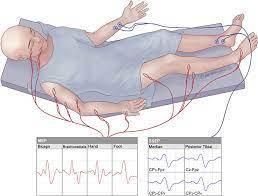 Ilustrasi Awake Brain Surgery