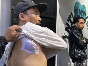 Kesaksian Akbar: Diajak Curhat Pengacara, Berakhir Didor di Punggung