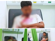 Tiga Penabrak Prada Yenjelmus Dirawat Intensif Setelah Diinterogasi POM