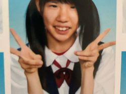 Transformasi Drastis Influencer yang Oplas Rp 2 M, Dipuji Makin Cantik