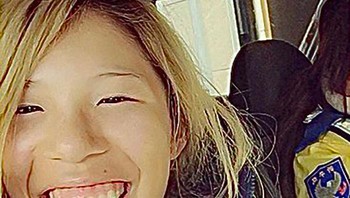 Pada usia 19 tahun, akhirnya Hirase menjalani prosedur bedah pertama kalinya. Tidak diketahui apakah di foto ini dia sudah menjalani oplas atau belum. Foto: X/Nyairin_518