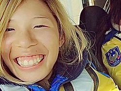 Transformasi Drastis Influencer yang Oplas Rp 2 M, Dipuji Makin Cantik