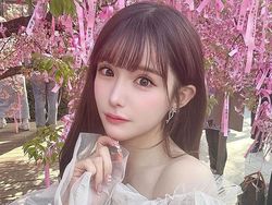 Transformasi Drastis Influencer yang Oplas Rp 2 M, Dipuji Makin Cantik