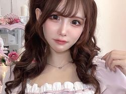 Transformasi Drastis Influencer yang Oplas Rp 2 M, Dipuji Makin Cantik