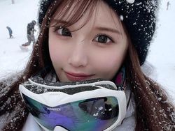 Transformasi Drastis Influencer yang Oplas Rp 2 M, Dipuji Makin Cantik