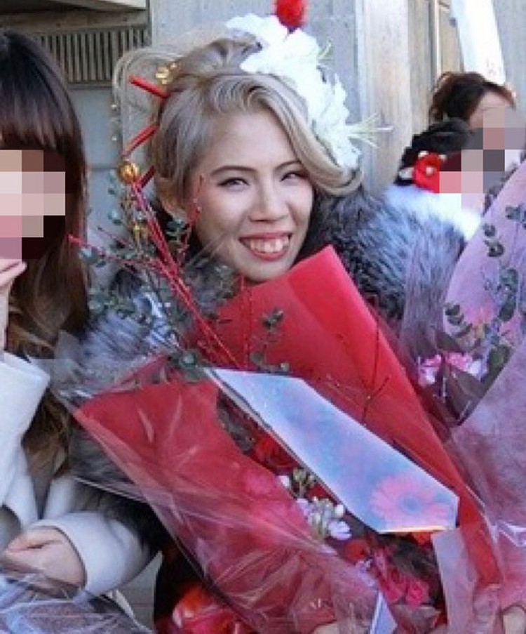 Transformasi Drastis Influencer yang Oplas Rp 2 M, Dipuji Makin Cantik X/Nyairin_518