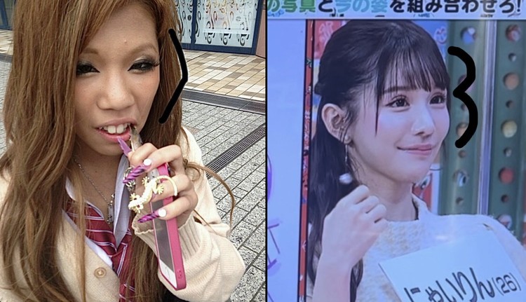 Transformasi Drastis Influencer yang Oplas Rp 2 M, Dipuji Makin Cantik X/Nyairin_518