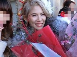 Transformasi Drastis Influencer yang Oplas Rp 2 M, Dipuji Makin Cantik