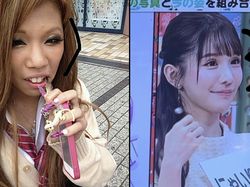 Transformasi Drastis Influencer yang Oplas Rp 2 M, Dipuji Makin Cantik