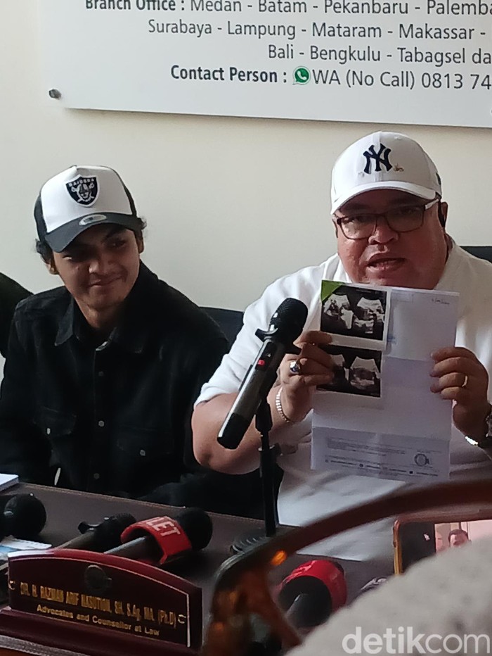 Vadel Badjideh tunjukan hasil USG anak Nikita Mirzani.