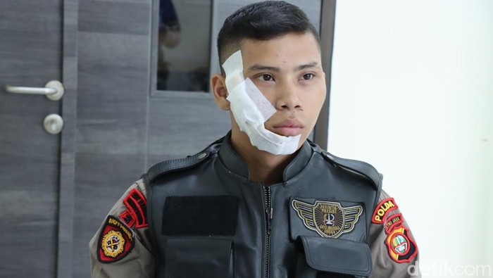 Bripda Gerald D Hargado, salah satu anggota Tim Patroli Perintis Presisi Polda Metro Jaya korban penyiraman air keras pelaku tawuran di Jakbar.