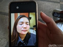 Bantah Penganiayaan, Mantan Suami Ancam Laporkan Balik Selebgram Dwita Qorin
