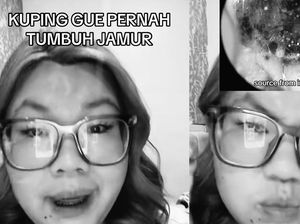 Viral Jamur Bersarang di Telinga Wanita Tangsel, Dokter THT Ungkap Penyebabnya