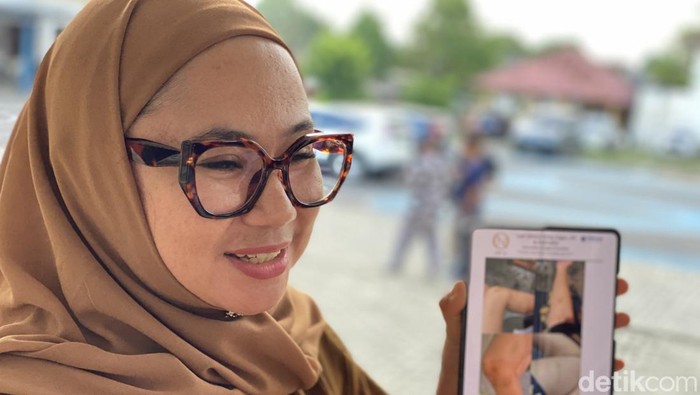 Kuasa Hukum korban, Nina Iqbal menunjukan luka lebam yang dialami IS.