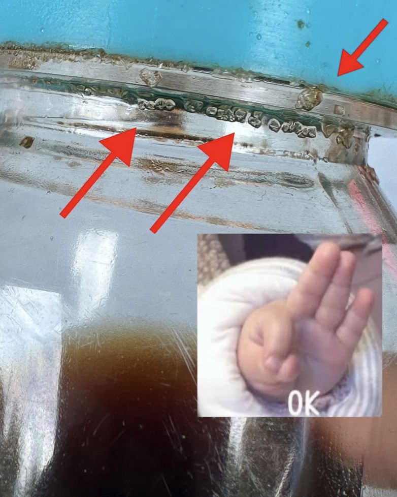 Hati-hati Bintik Putih di Botol Kecap Asin Pertanda Bahaya Ini!