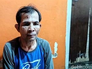 Fitnah Keji Bikin Wajah Jujun Pedagang Es Keliling Babak Belur