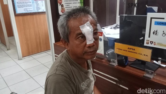 Sobri (58) pedagang pasar di Palembang lapor polisi usai dianiaya preman karena masalah lapak