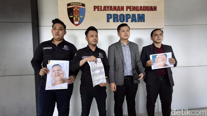 Tim kuasa hukum korban penganiayaan laporkan oknum penyidik ke Propam Polda Sumsel.
