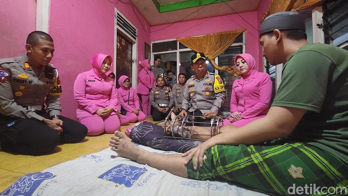 Kapolres Sukabumi AKBP Samian saat mengunjungi korban kecelakaan