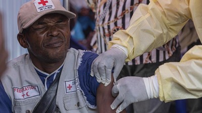 Kongo Mulai Gelar Vaksinasi Wabah Mpox, Begini Potretnya