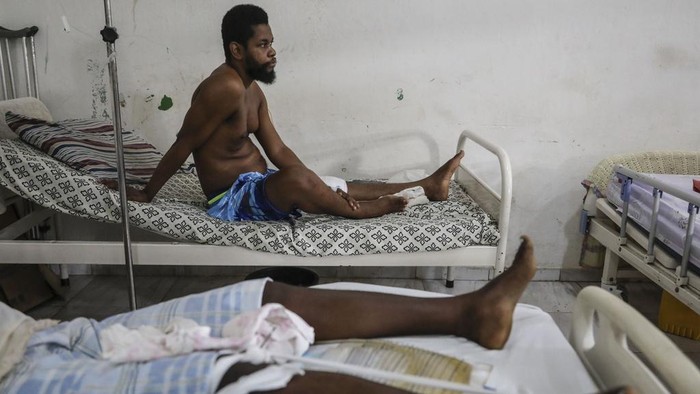 Exiles Junior, wounded by a bullet during armed gang attacks, sits up on a bed at Saint Nicolas hospital in Saint-Marc, Haiti, Sunday, Oct. 6, 2024. (AP Photo/Odelyn Joseph)