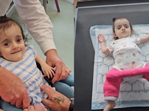 Kisah Pilu Bayi Idap Kondisi Langka, Tulangnya Bisa Patah 70 Kali dalam Setahun