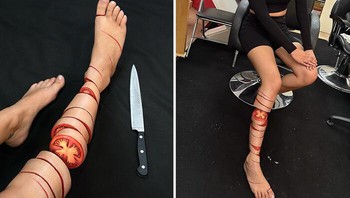 Kakinya dipotong-potong. Foto: Instagram/@mimles