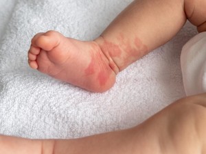 Polisi Ungkap Kondisi Bayi yang Dibuang Ibunya ke Tempat Sampah di Jakut